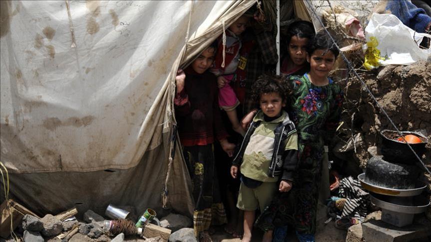 أجسادهم تحولت إلى هياكل عظمية.. الجوع يلتهم أطفال اليمن (تقرير)