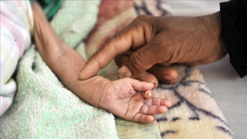 Yemenli çocuklar açlıkla mücadele ediyor