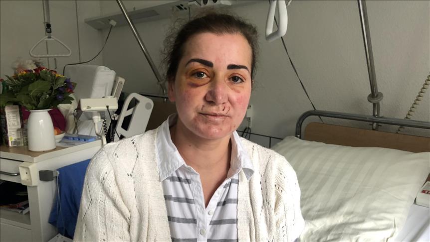 Almanya'da Türk kadınının saldırıya uğramasına ilişkin Köln polisi araştırma başlattı