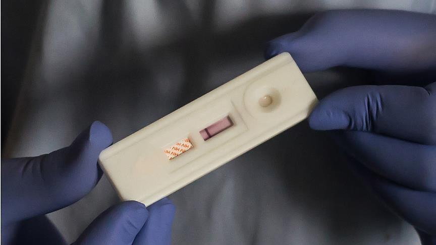 UN: Oko 9,4 miliona osoba u svijetu ne znaju da su zaraženi HIV-om