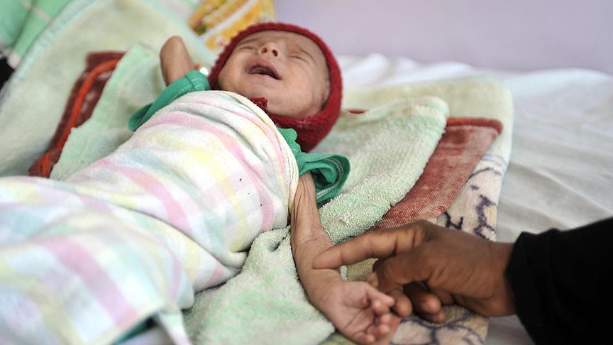 İnsani krizin pençesindeki Yemen'in gözü İsveç'teki müzakerelerde