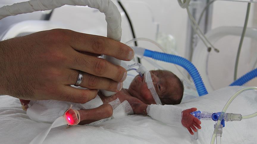 514 gram doğan bebeğe 'hayat' operasyonu