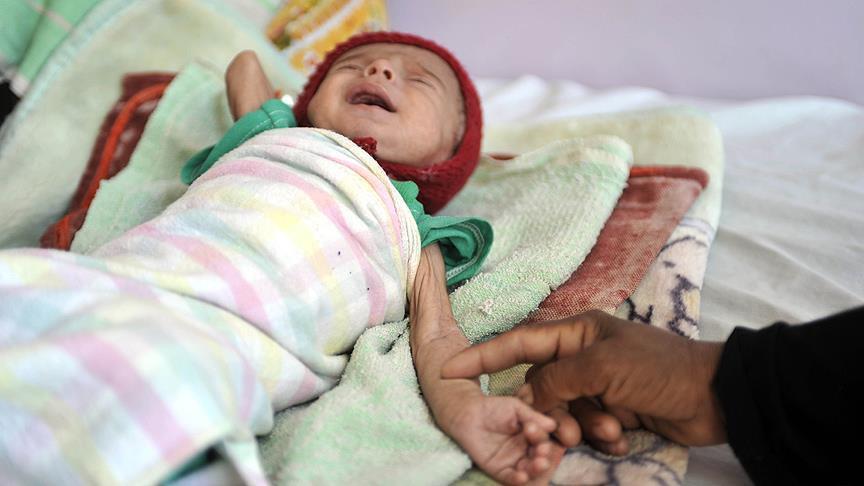 Yemen calls for more humanitarian aid from Turkey