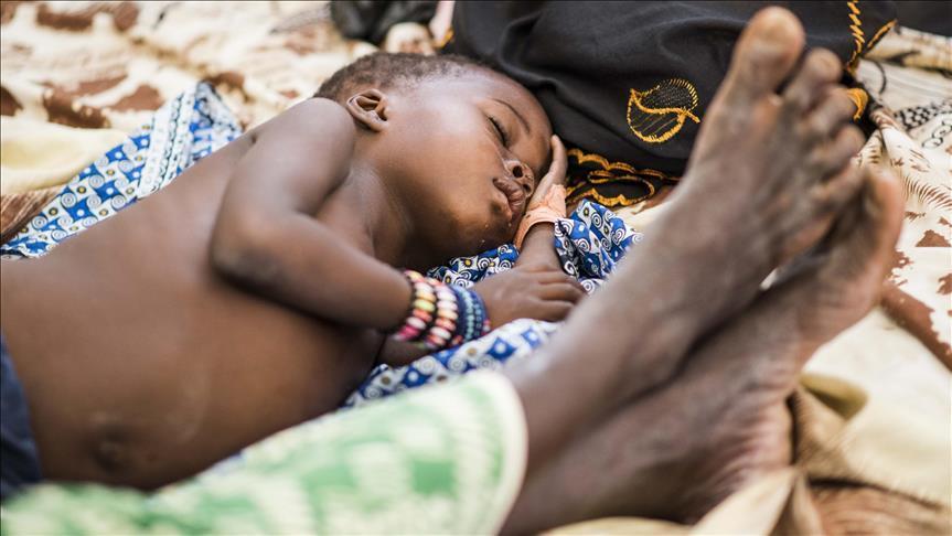 Child malnutrition worsened in insurgency-hit Nigeria 