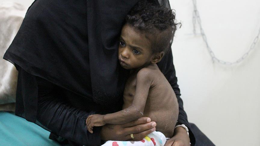Children bear brunt of Yemen’s ongoing conflict
