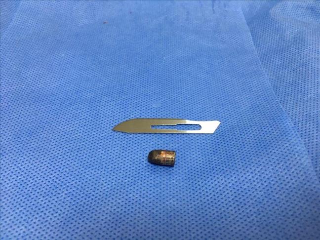 Sarhoş sanılan kişinin kafasındaki mermi çıkarıldı