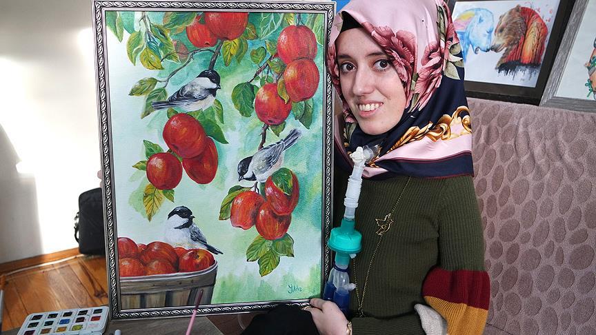 Kas hastası genç kız umutlarını tuvali ve kalemiyle yaşatıyor