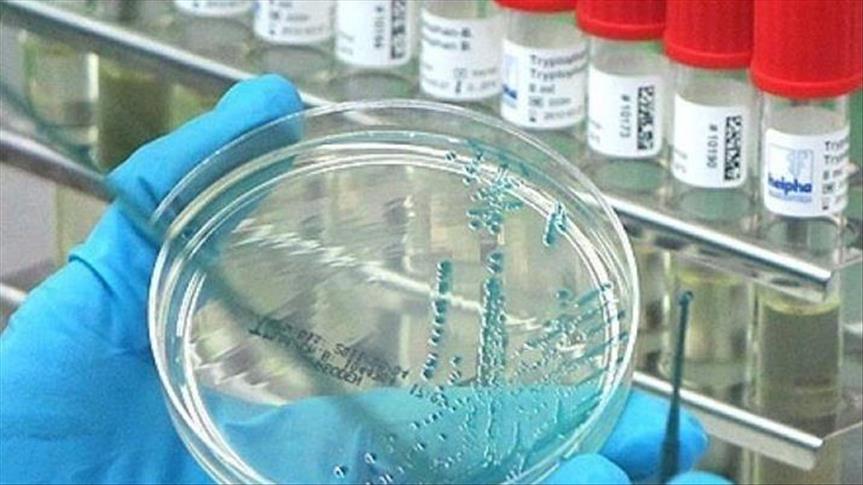 ‘Swine flu’ leaves 5 dead in Morocco: Health minister