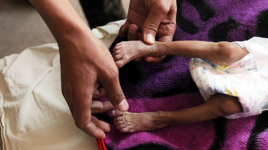 Војната во Јемен прерасна во хуманитарна криза: Жителите немаат пристап до помошта и храната