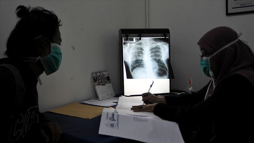 Çdo ditë rreth 4.500 persona në botë vdesin nga tuberkulozi