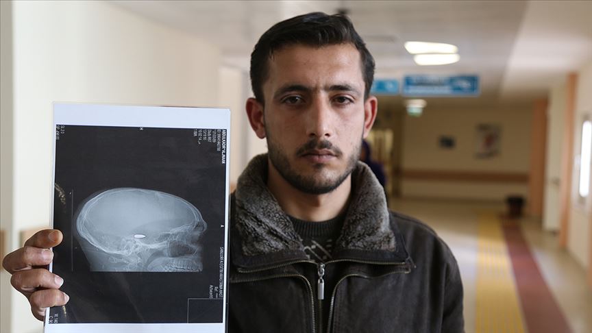 Savaş mağduru hayatını başındaki mermiyle sürdürecek