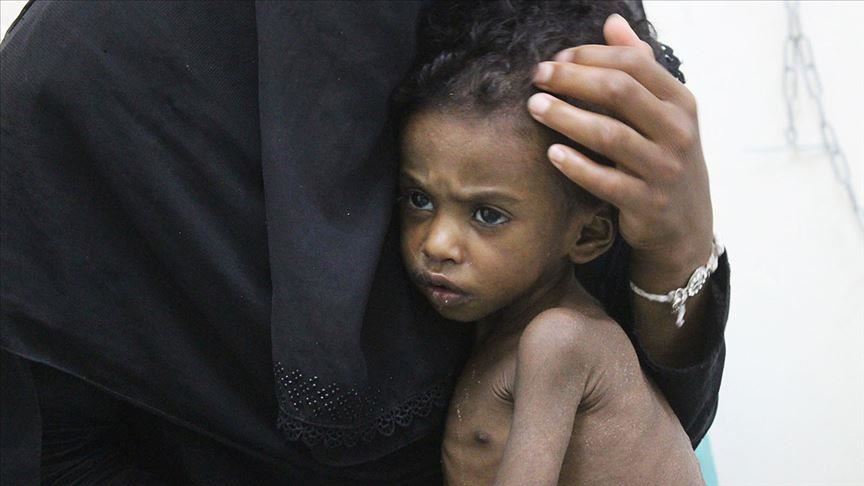 ONU : 113 millions de personnes issues de 53 pays touchées par la famine