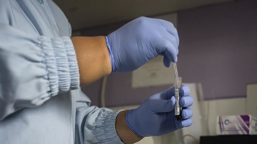 Over 90 test positive for HIV in southern Pakistan
