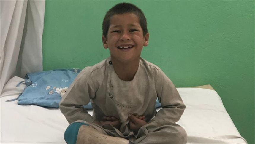 World shares Afghan child’s joy, grief after viral video