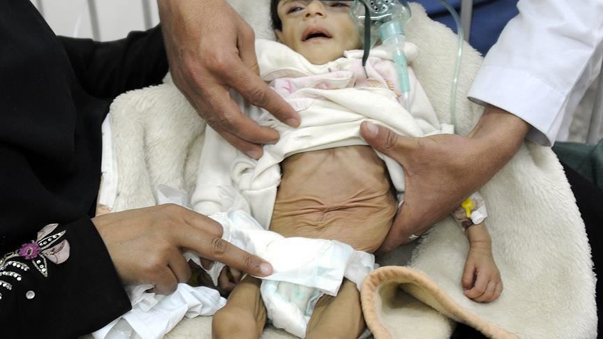 مديرة "يونيسيف": مقتل 7300 طفل منذ بدء الصراع في اليمن