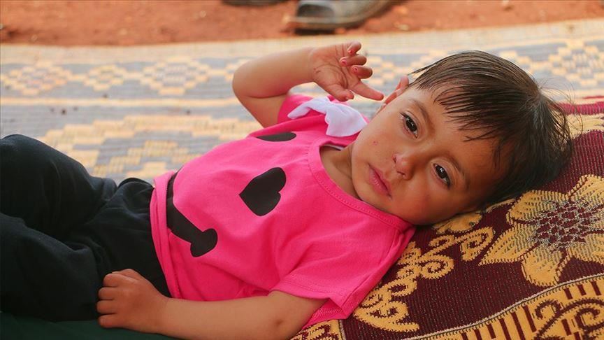 Спас од нападите најдоа во Идлиб: Сириското девојче Аја итно треба да го оперира срцето