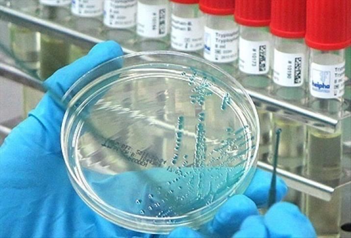 1.700 orang tewas akibat Ebola di Kongo