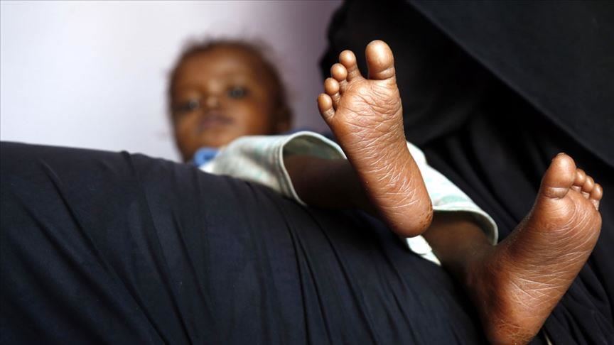 335 Yemeni children killed in past year: Oxfam