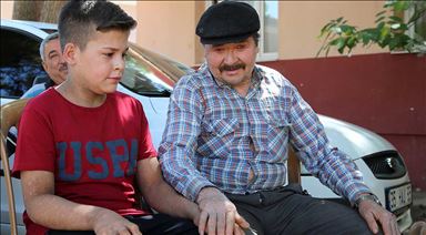 'Balık pulu' hastası 150 kişi rahatça dışarı çıkmak istiyor