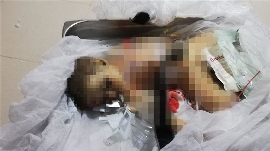 9-месячный ребенок стал жертвой террористов РКК
