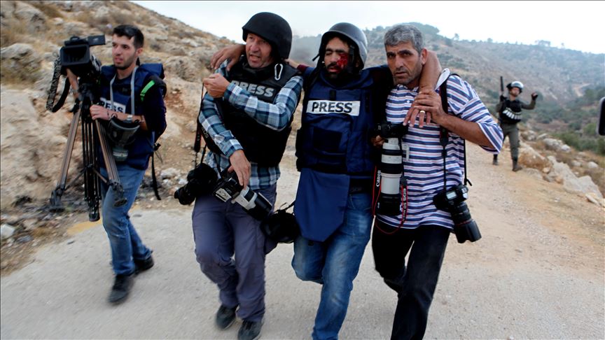 Palestinian journalist loses his eye by Israeli bullet