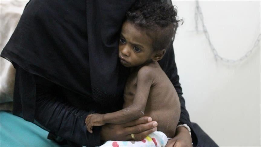 الأمم المتحدة: أكثر من نصف قتلى صراع اليمن أطفال ونساء