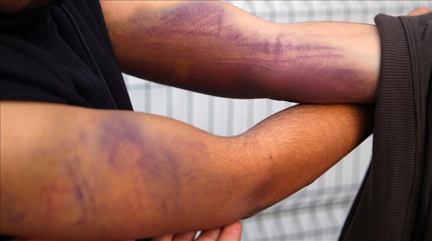 Turkey treats migrants allegedly beaten by Greek troops