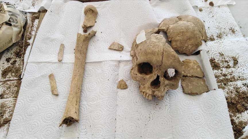 3,500-year-old skull found in central Turkey