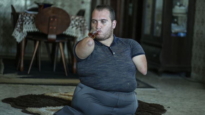  غزّة... هكذا يصرّ "يوسف" على الحياة بنصف جسد (قصة إنسانية)