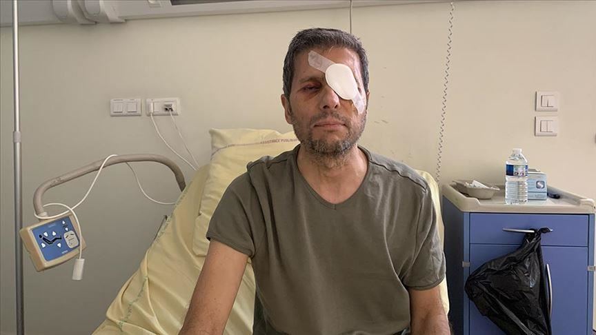 Reporter AA Yalcin prisjetio se protesta u Parizu tokom kojih je ranjen u oko