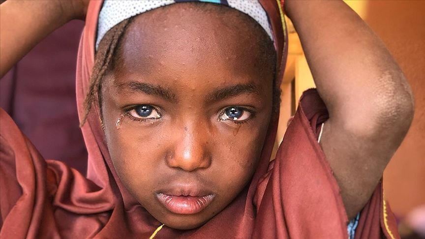 Turkish charity helps girl at risk of losing eyesight