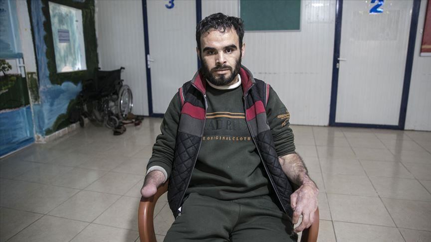 Turquie: Le réfugié syrien Rafid Maguni attend de bénéficier d'une prothèse de main