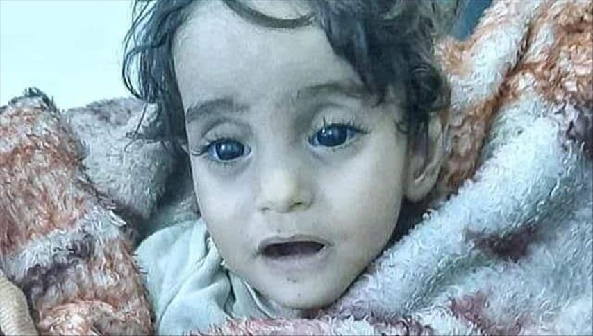 Iman Ahmed, petite syrienne morte de froid les yeux grands ouverts