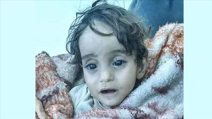 Foshnja siriane vdes nga i ftohti me sytë hapur