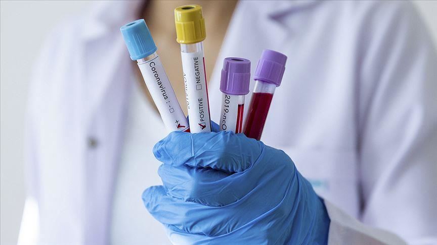 Iran confirms first two deaths from coronavirus