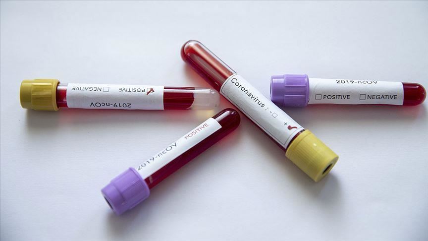 Iran reports 3 new coronavirus cases