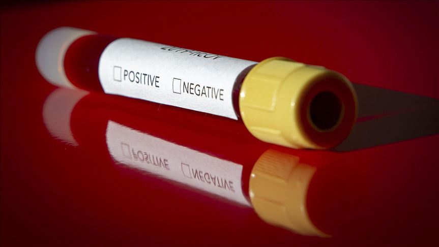 Zagreb: Testiranje šest uzoraka na korona virus u Klinici za infektivne bolesti „Dr. Fran Mihaljević“