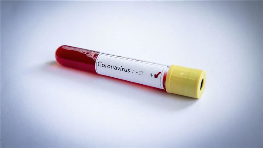 "Në Shqipëri nuk ka asnjë rast të konfirmuar me koronavirus" 