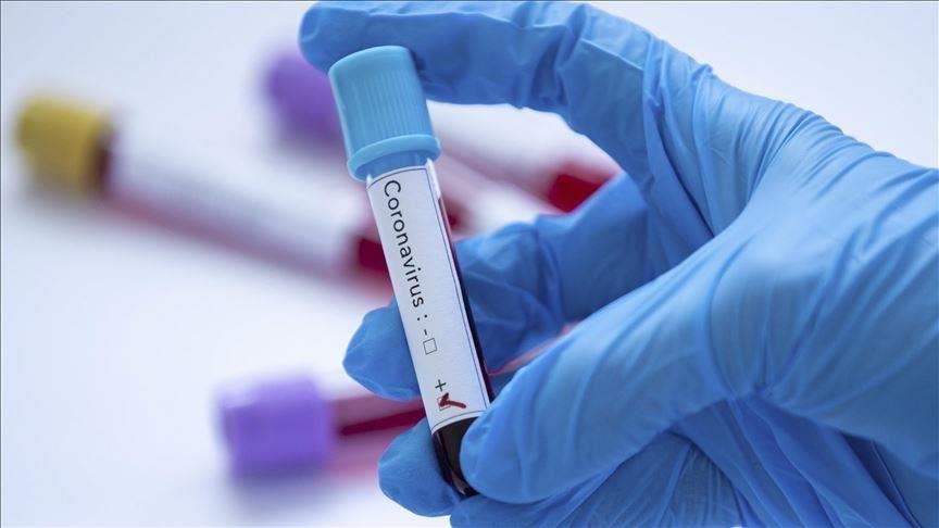 Coronavirus: San Francisco declares state of emergency