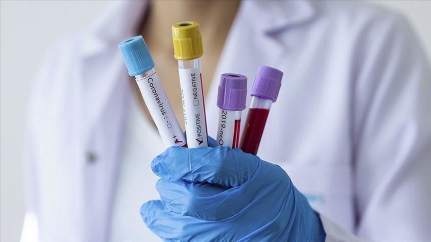 US: California confirms 33 cases of new coronavirus