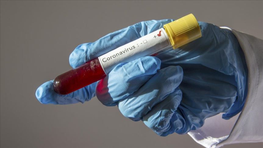 Primer caso de coronavirus en EEUU de origen desconocido