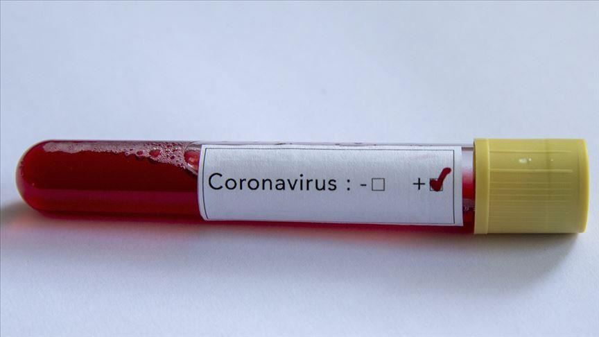 Netherlands announces first coronavirus case