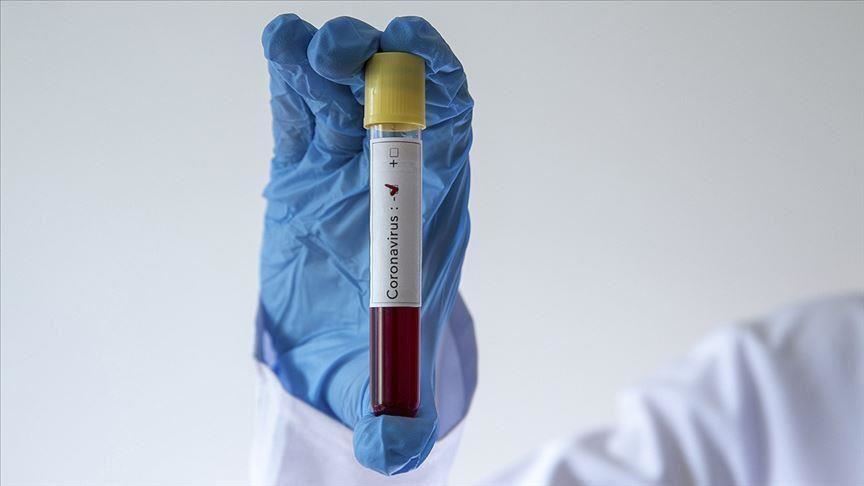 Saudi Arabia confirms first coronavirus case 
