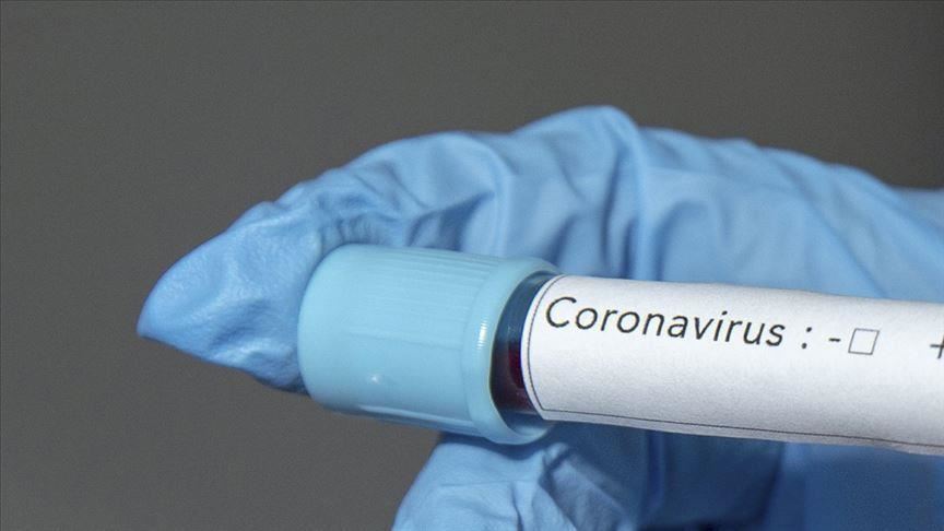 Iraq's coronavirus cases rise to 21