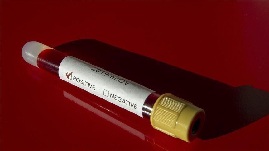 Senegal confirms first coronavirus case