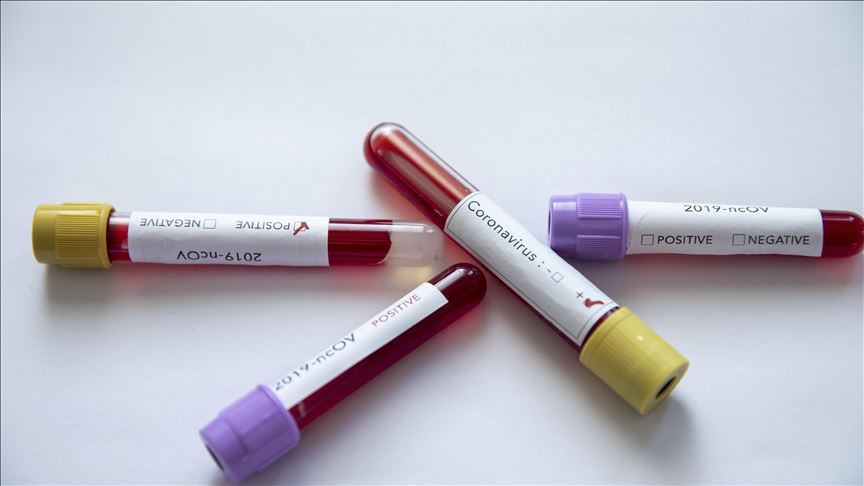 Gobierno de Chile confirma primer caso de coronavirus en el país
