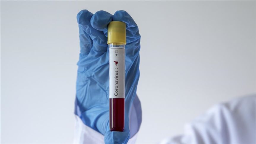 Egipto confirma 12 casos de coronavirus