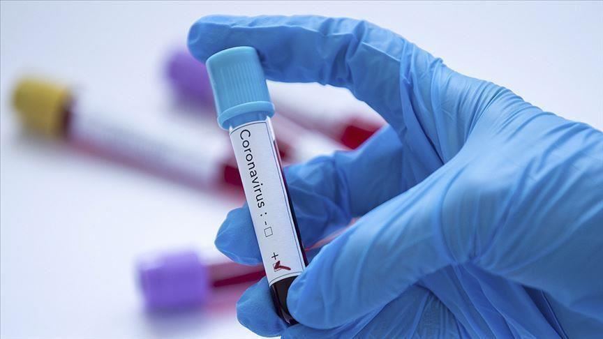 Togo confirms 1st coronavirus case