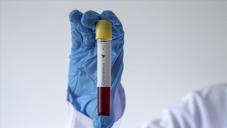 Irak'ta koronavirüsü yenen bir kişi hastaneden taburcu edildi