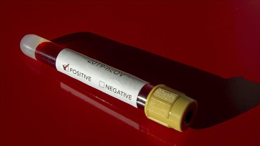 Covid19 les Émirats arabes unis enregistrent 15 nouveaux cas de